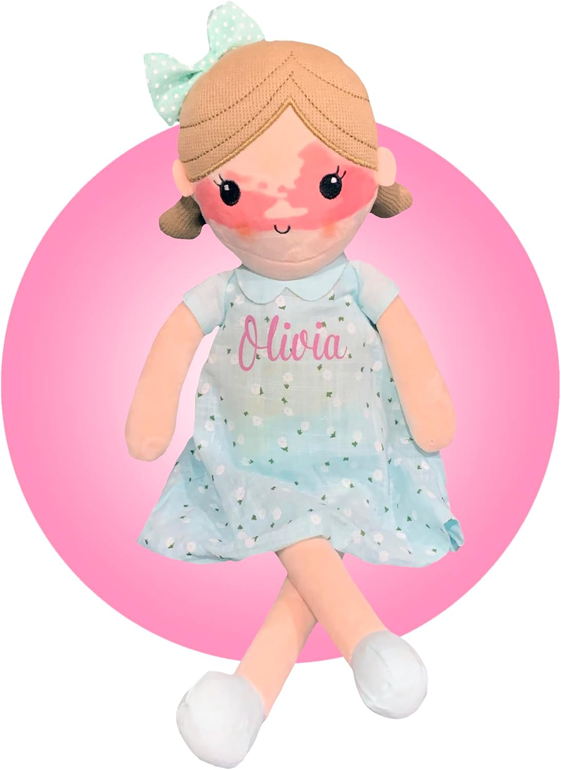 Port Wine Stain 14" Custom Dolls - You Supply The Photo; We Replicate it to The Doll - Personalized Port Wine Stain Birthmark Dolls - Baby Dolls with Birthmarks