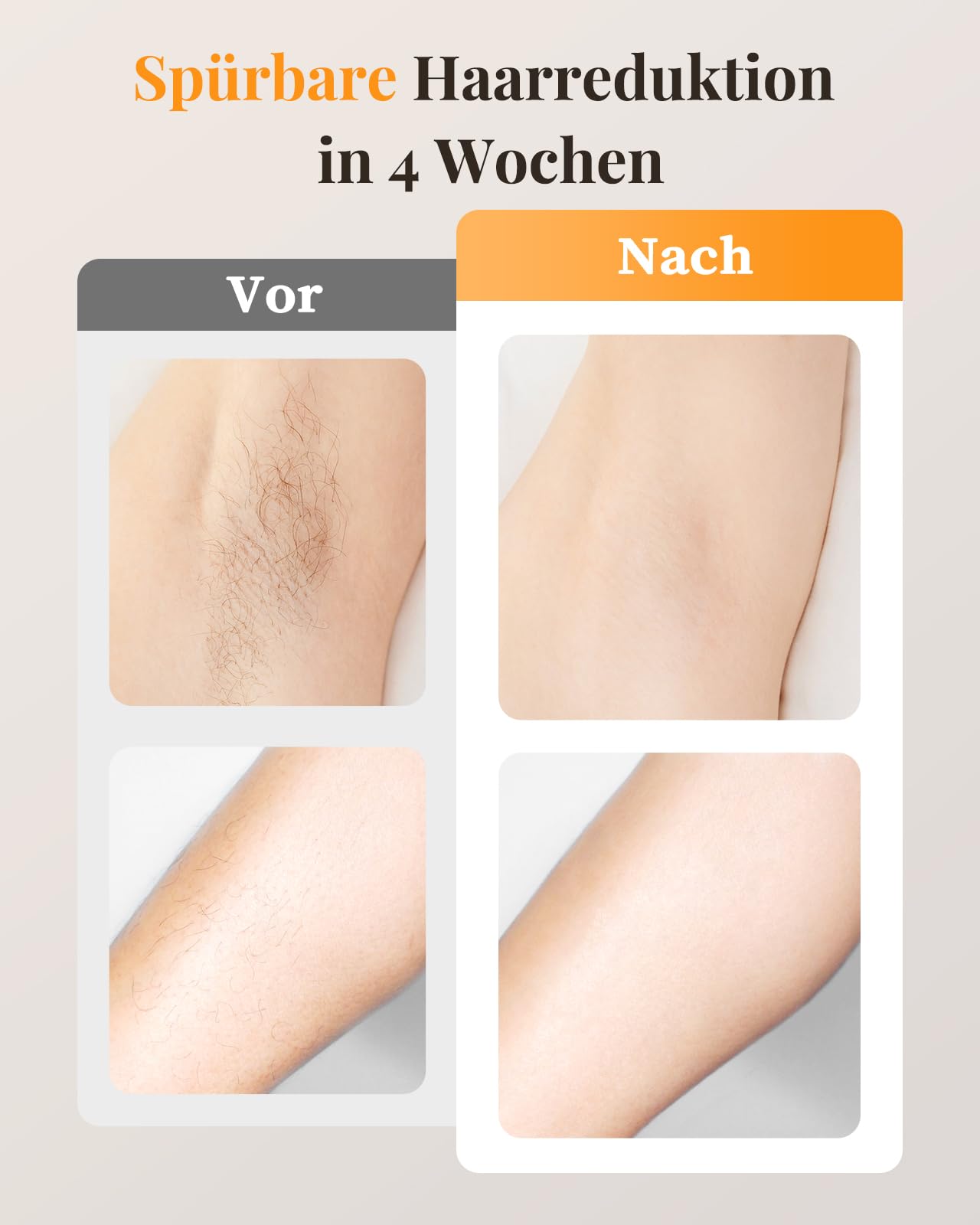 Haarlosy IPL Geräte Haarentfernung mit Gefrierfunktion, 999,900 Lichtimpulse 9 Intelligente Energiestufen Haarentfernung Laser, Schmerzfreie Haarentfernungsgerät für Männer, Frauen, Körper zu Hause