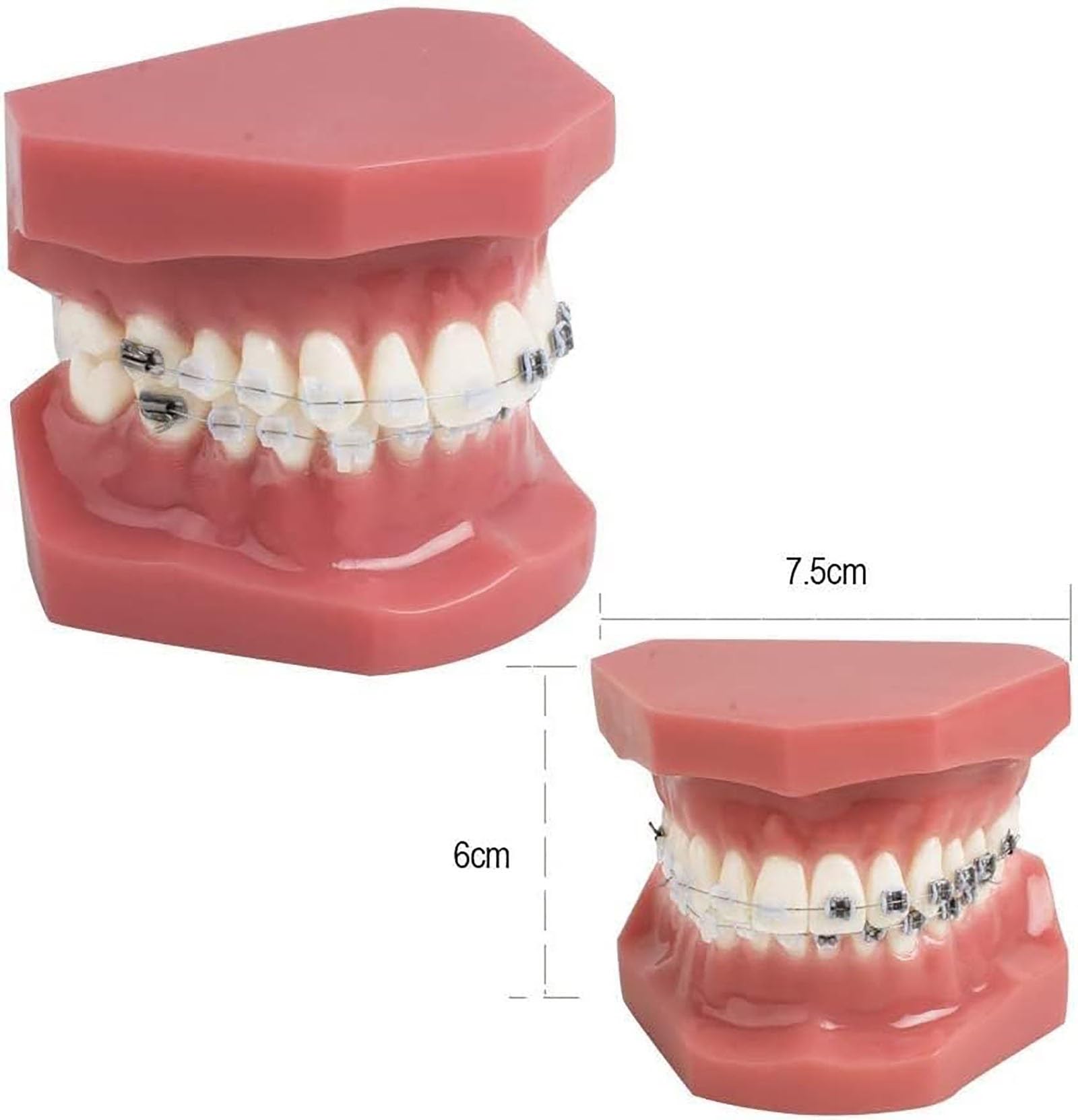 Zahnärztliches kieferorthopädisches Modell, Zahnmodell mit Metall- und Keramikklammern, orale Demonstrationsmodelle for den zahnärztlichen Unterricht oder die Kommunikation mit dem Zahnarzt.