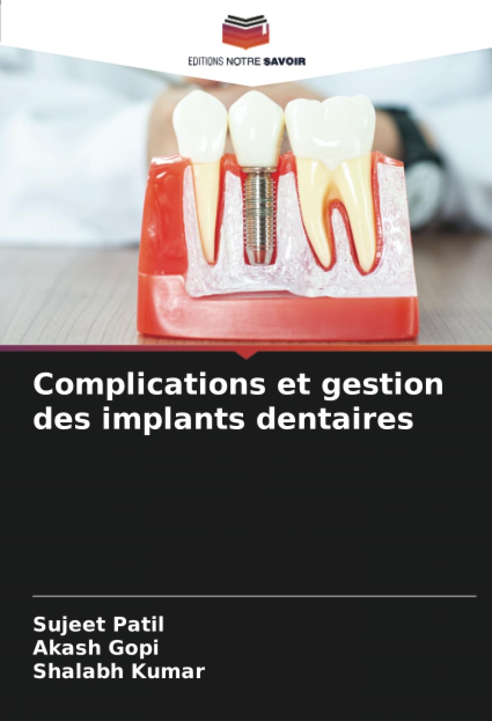 Complications et Gestion des Implants Dentaires : Guide Pratique pour Dentistes