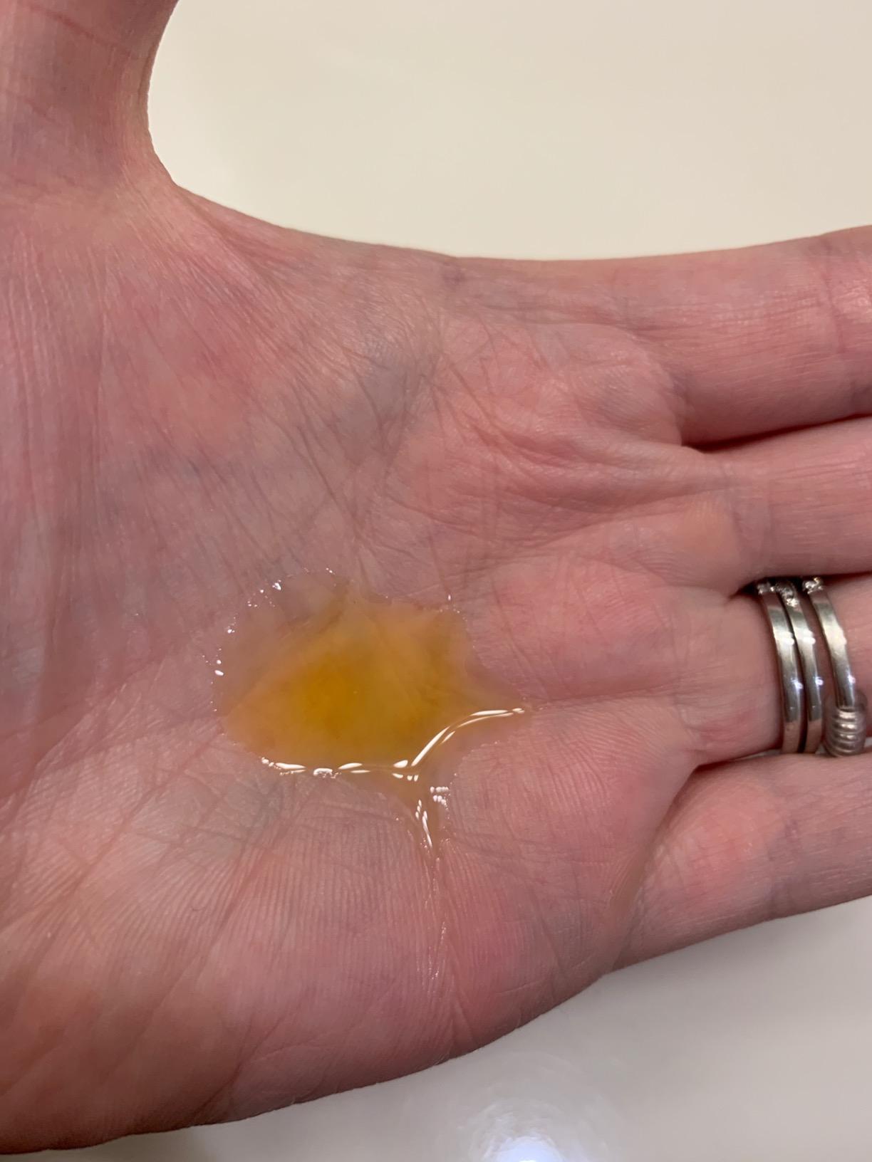 If you have dry skin you might still need a moisturizer