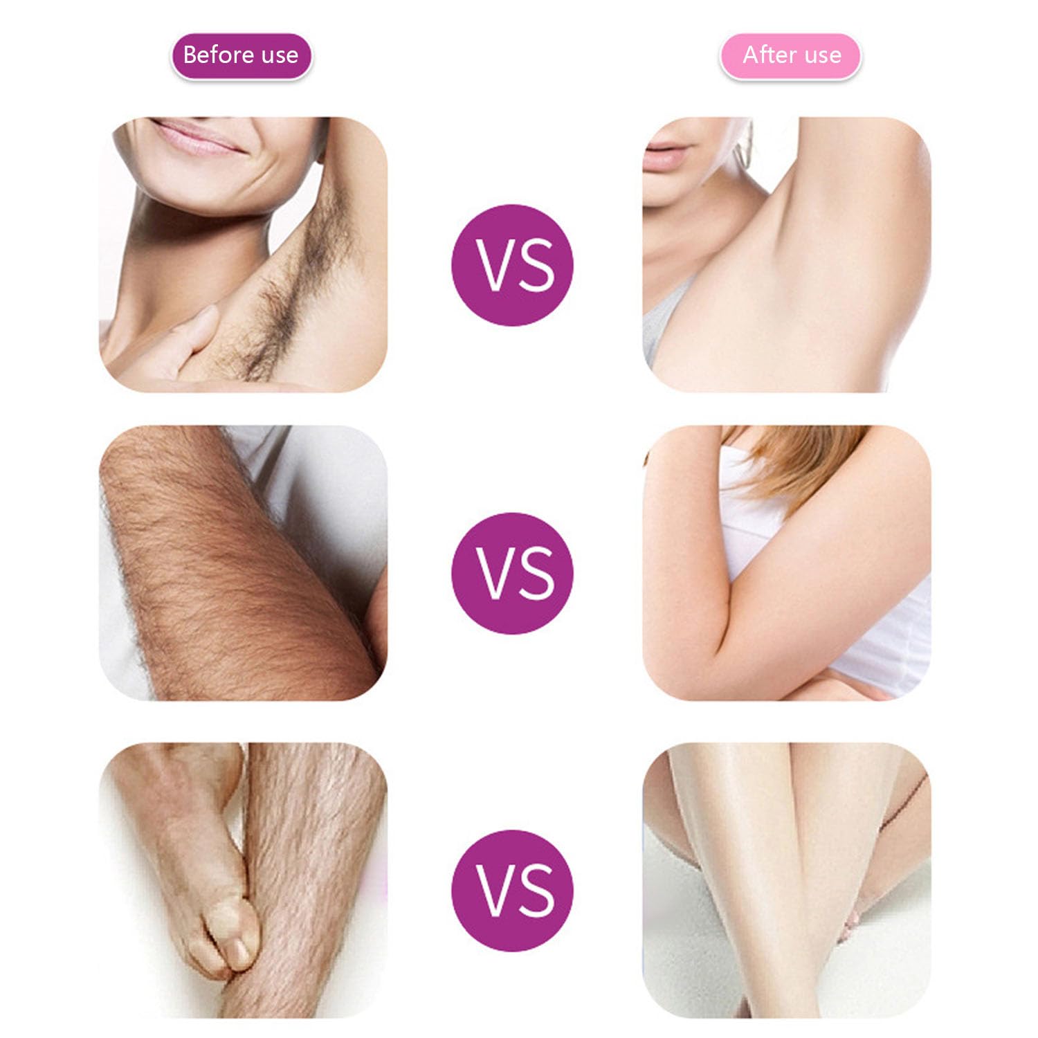 Spray D'épilation De Beauté Soyeuse, Mousse De Pulvérisation D'épilation, Mousse D'épilation, Crème Dépilatoire, Dépilador De Pulvérisation De Beauté Soyeuse De 150 Ml (3pcs)