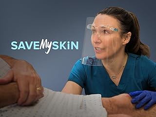 Save My Skin