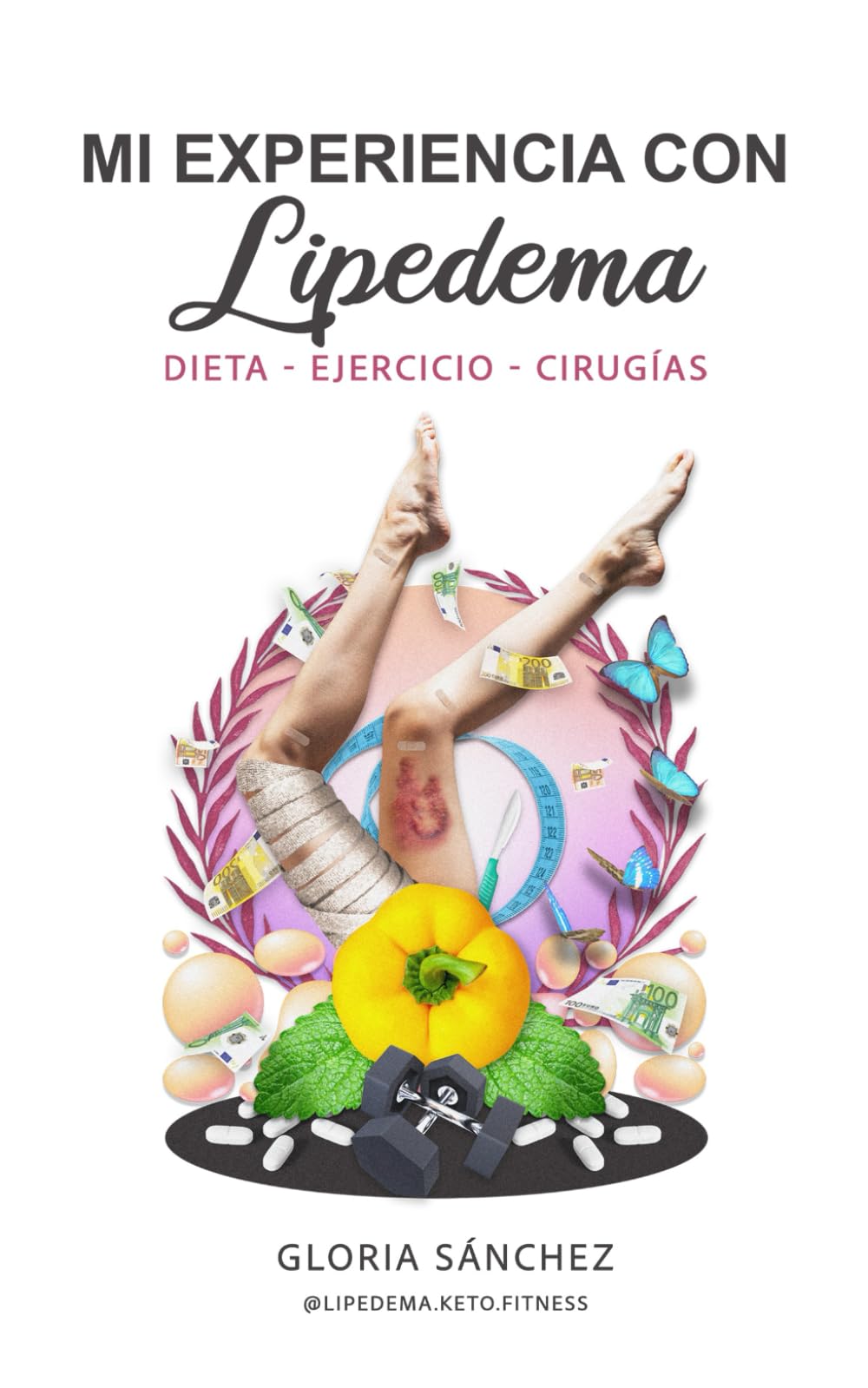 MI EXPERIENCIA CON LIPEDEMA: Dieta - Ejercicio - Cirugías