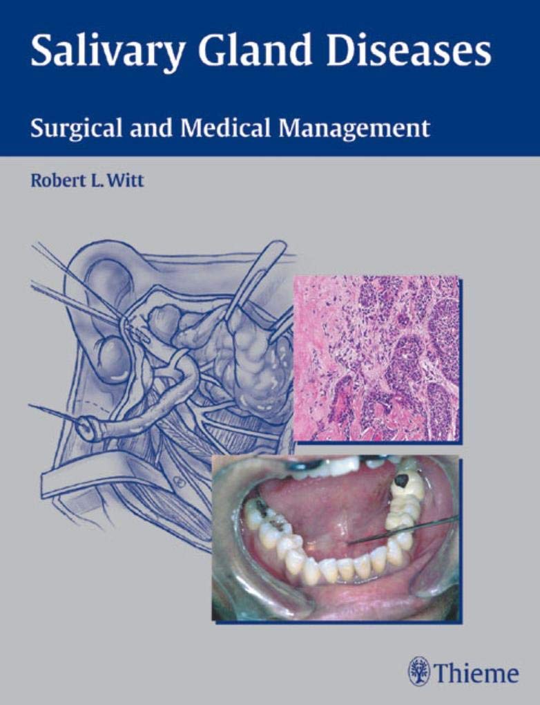 Buy Salivary Gland Diseases: Surgical and Medical Management — BookShops.in