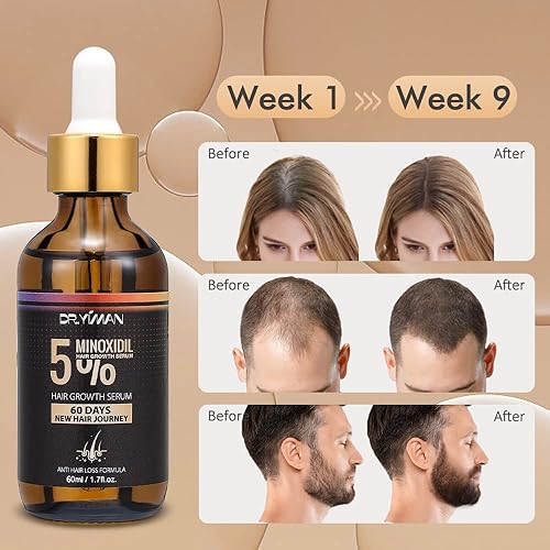 Miniatura 3 de Suero de crecimiento del cabello de minoxidil al 5% para hombres y mujeres, aceite de suero para el crecimiento del cabello para la pérdida de