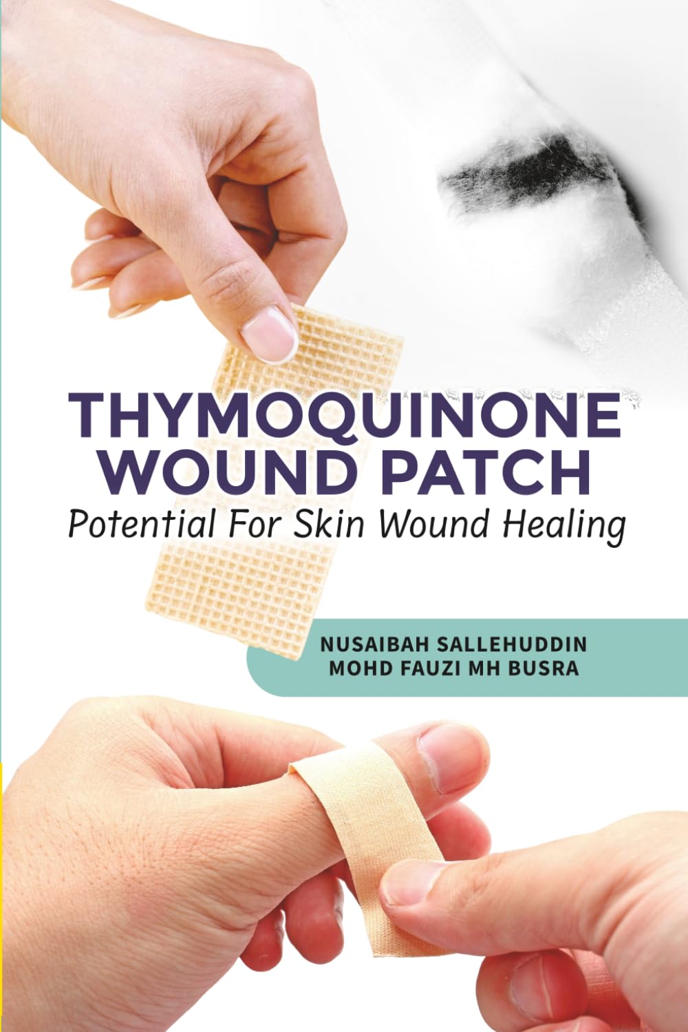 Thymoquinone Wound Patch Potential For Skin Wound Healing