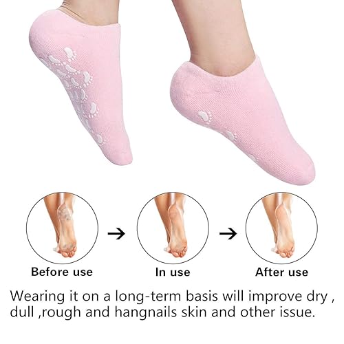 Miniatura 4 de Calcetines hidratantes de gel para el talón  Tratamiento de cuidado de pies áspero callos con forro de gel de silicona suave, calcetines de spa  2