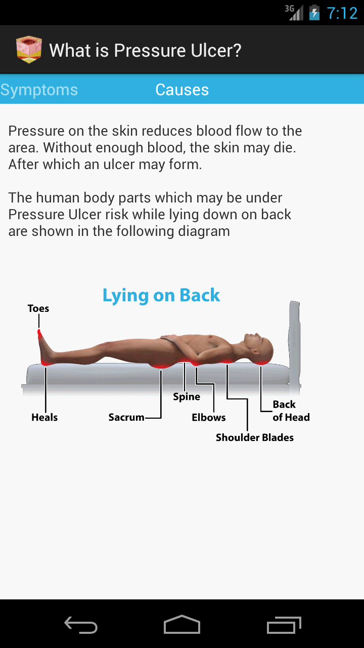 Bedsores Symptoms, Causes And Treatment Happiest Health