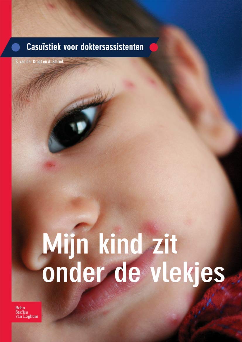 Mijn kind zit onder de vlekjes: Casuïstiek voor doktersassistenten