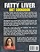 Fatty Liver Diet Cookbook: 2000+ Days of Balanced, Hepatic Recovery Recipes for Beginners | Supportive Guide to Restore, Detoxify and Promote Organ Health| Includes Nutritive Healing 60-Day Meal Plan