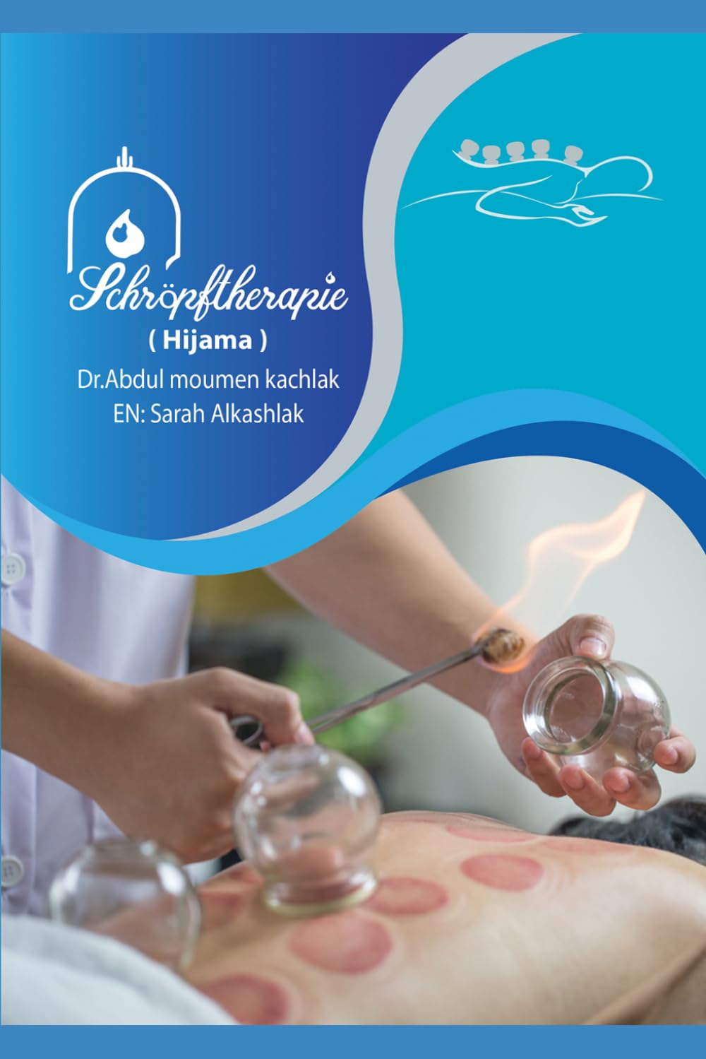 Schröpftherapie -Hijama: Schröpfen für Gesundheit und Schönheit