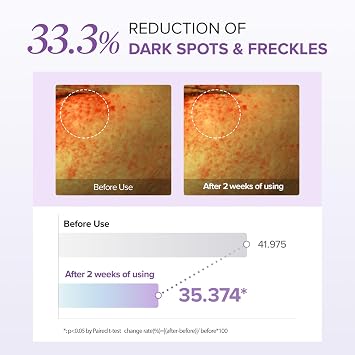 Mary&May Tranexamic Acid + Glutathione Eye Cream Set (1,000ppm each) Brightening Under Eye Cream for Dark Circles & Uneven Tone, Vitamin C, Niacinamide 1.06 oz + 0.8 oz
