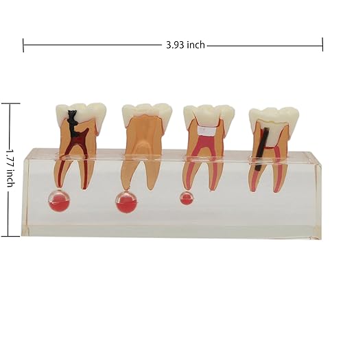 Miniatura 6 de ​Modelo de tratamiento endodóntico Dentalmall, de cuatro etapas, para enseñar a estudiantes, modelo 4018