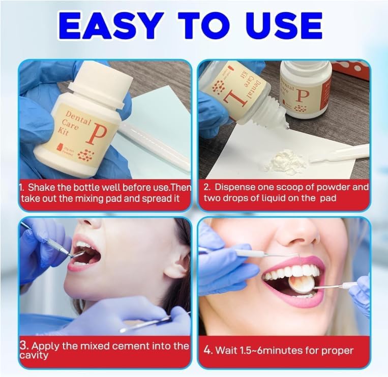 Dental Care Kit Zinc Oxide Eugenol Cement, Tooth Repair Kit for Crowns Filling, Temporary Teeth Fix for Confident Smile
