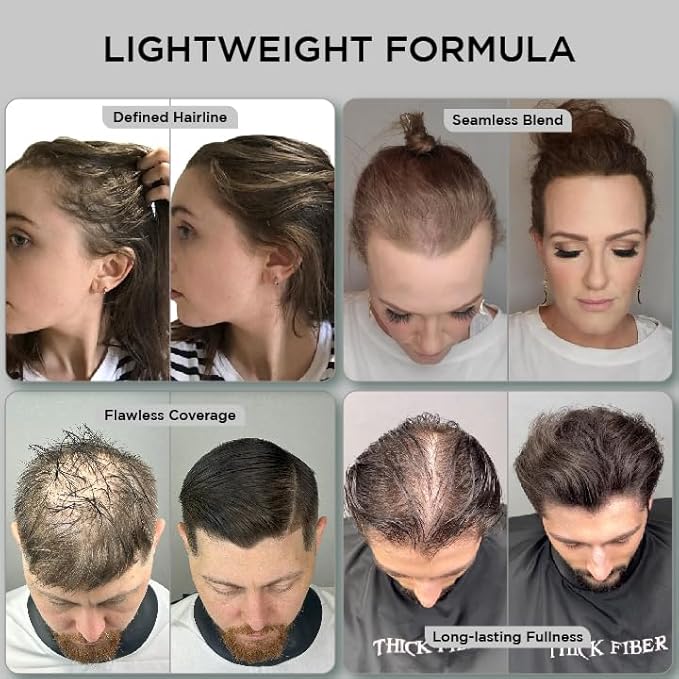 THICK FIBER Hair Fibers for Thinning & Bald Spots (DARK BROWN, Pack of 2) - 25g Bottle - Conceals Loss in Seconds - Powder for Women & Men