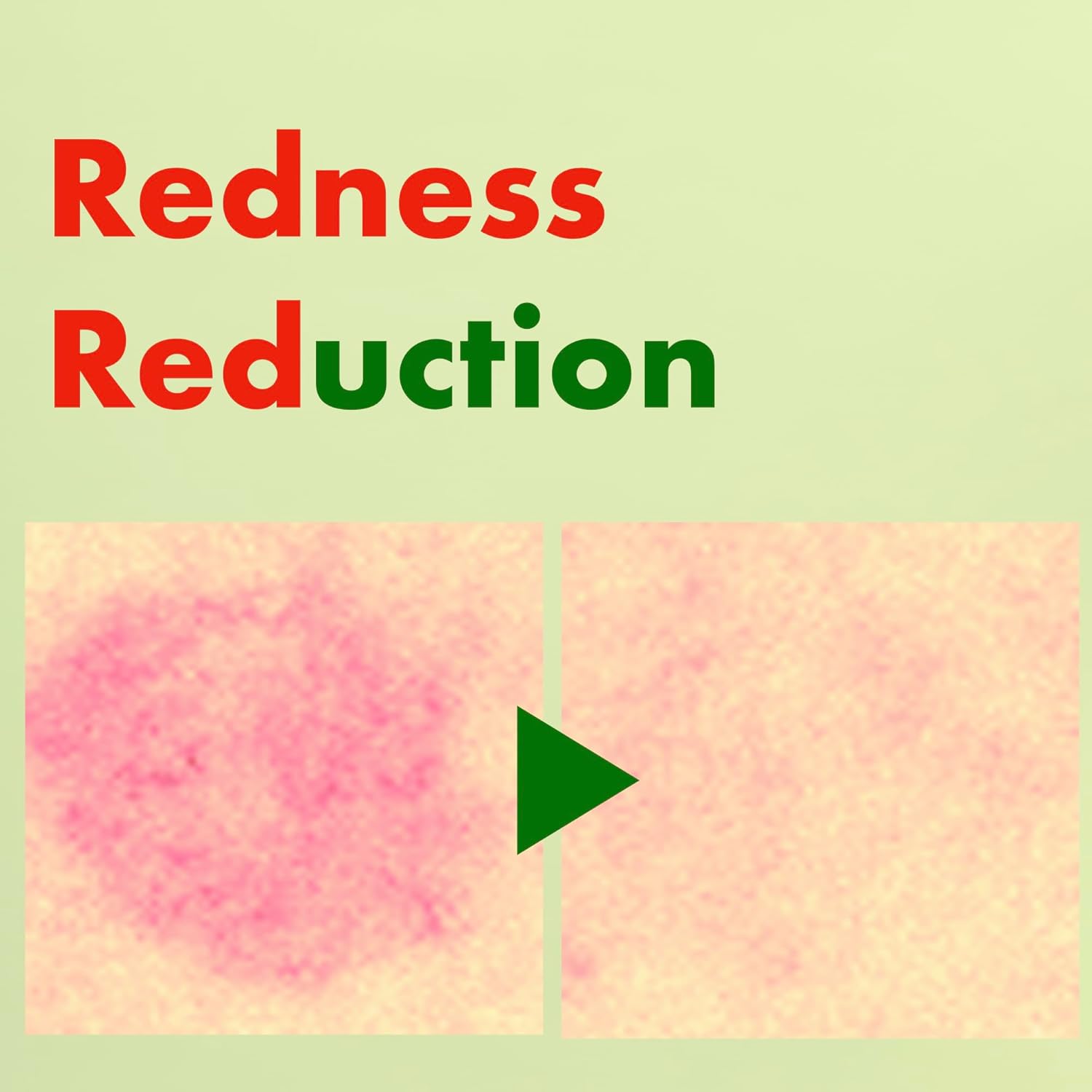 ISOI Moisture Dr. Ampoule, Deep Hydration and Barrier Repair Serum with Tea Tree Ceramide and 5 Hyaluronic Acids for Dry and Sensitive Skin, Korean Skin Care (1.35 fl.oz, 40ml) - Image 7