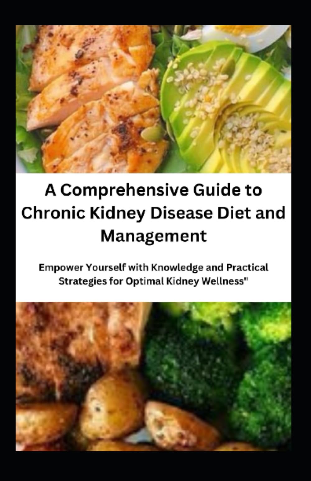A Comprehensive Guide to Chronic Kidney Disease Diet and Management: Empower Yourself with Knowledge and Practical Strategies for Optimal Kidney Wellness