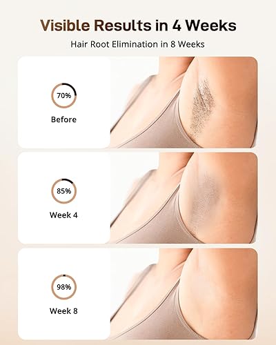 Miniatura 3 de LYSMOSKI Depilación láser con sistema de enfriamiento, depilación IPL permanente para mujeres y hombres, dispositivo de depilación 3 en 1 en casa