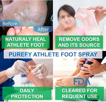 PUREFY Athlete Foot Airesol Spray for Skin (3.4oz, 2pk), Purefypro Dermal Technology, Natural Healing of Athlete Foot. Remove Odor. No Residue Clear Spray and Safe for Everyone