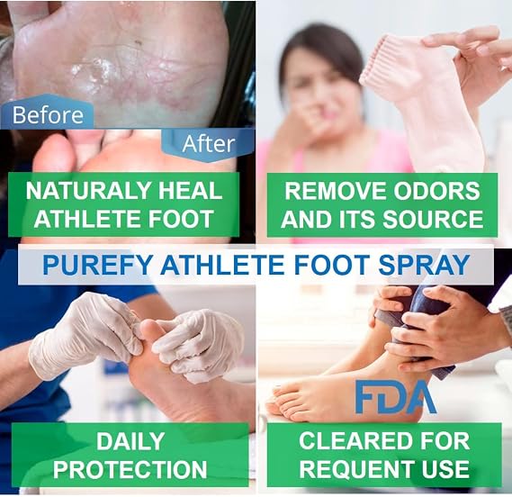 PUREFY Athlete Foot Airesol Spray for Skin (3.4oz, 2pk), Purefypro Dermal Technology, Natural Healing of Athlete Foot. Remove Odor. No Residue Clear Spray and Safe for Everyone