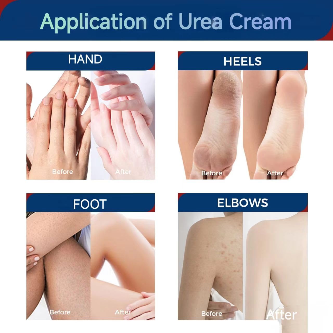 OUKEYA Urea Cream 42 Percent with 2% Salicylic Acid Tube 3 Oz, Foot & Hand Cream for Dry Cracked, 3 Pack
