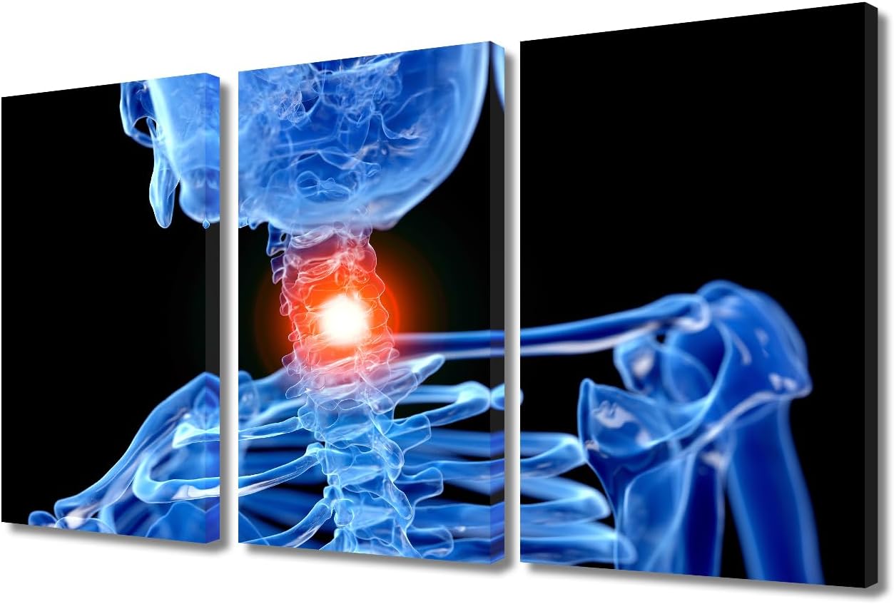 TUMOVO Neck Pain Painting Posters House Deocration for Living Room Human Spine X-Ray Canvas Prints Wall Decor Skeletal System Anatomy Wall Art for Office Modern Artwork Ready to Hang - 36" Wx24 H Artwork-15 24x36inch