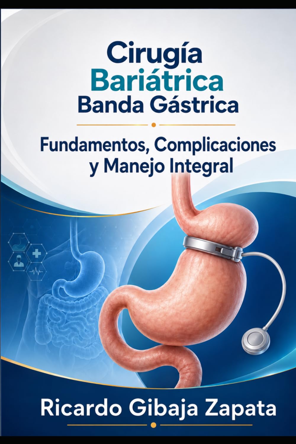 Cirugía Bariatica Banda Gástrica Fundamentos, Complicaciones y Manejo Integral