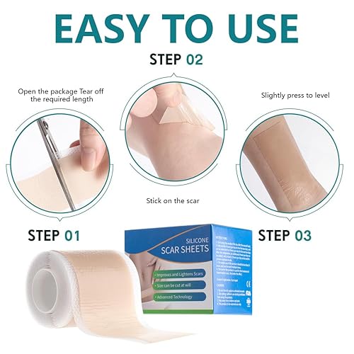 Miniatura 4 de Hojas de silicona para cicatrices de 1.57 x 59 pulgadas, cinta de silicona extra larga, tiras de silicona para cicatrices, suministros de vendaje de