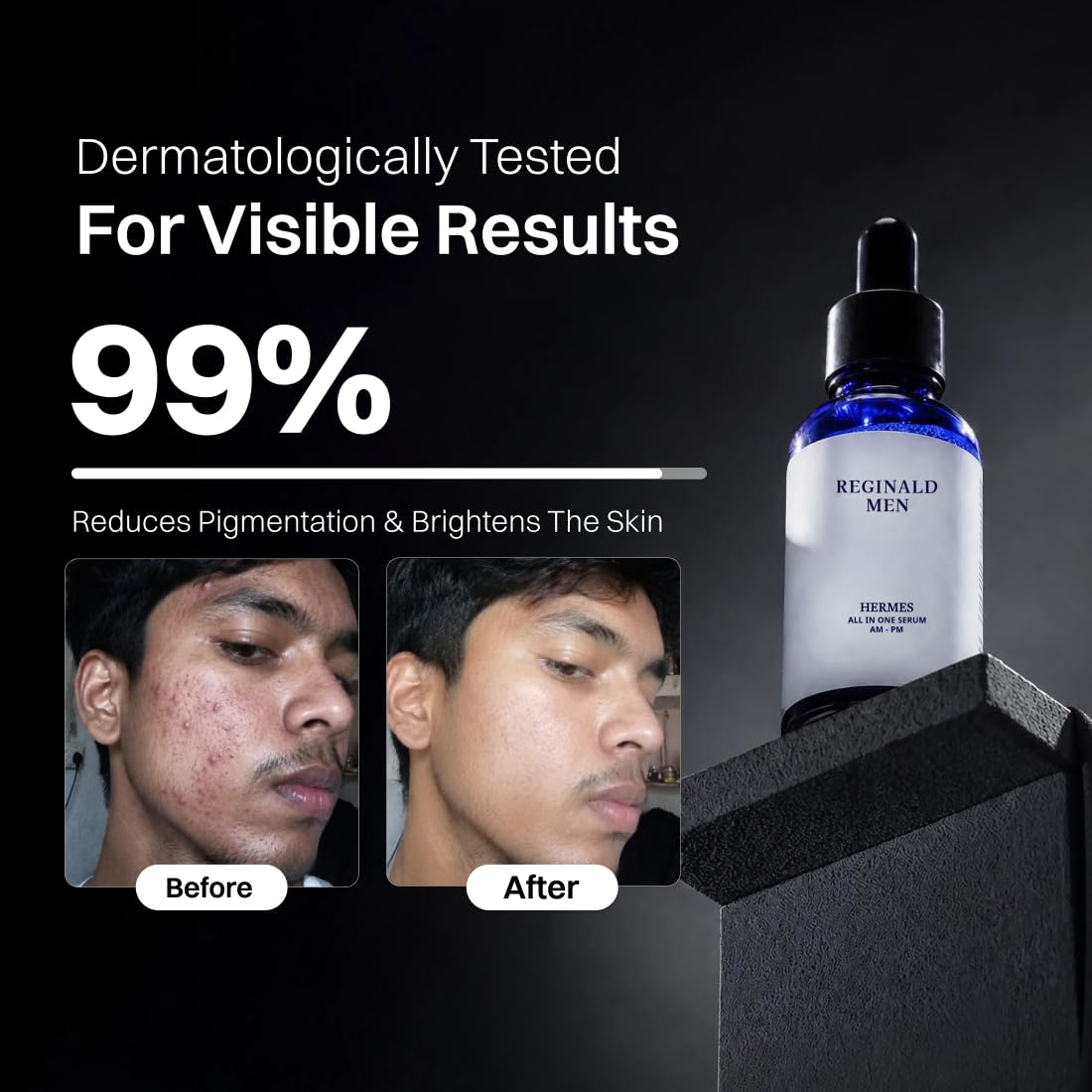 Reginald Men Hermes (30 ml) | All-in-One Face Serum for Skin & Beard Health | Multi-Functional Face & Beard Care | Hydrates, Nourishes & Strengthens | Clinically Proven Formula for Clear, Healthy Skin & Beard 2