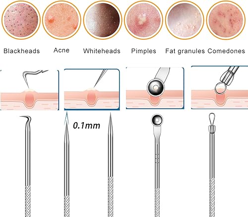 Miniatura 4 de Kit de eliminación de puntos negros de acero inoxidable, kit de herramientas para reventar espinillas, pinzas de espinillas, extractor de