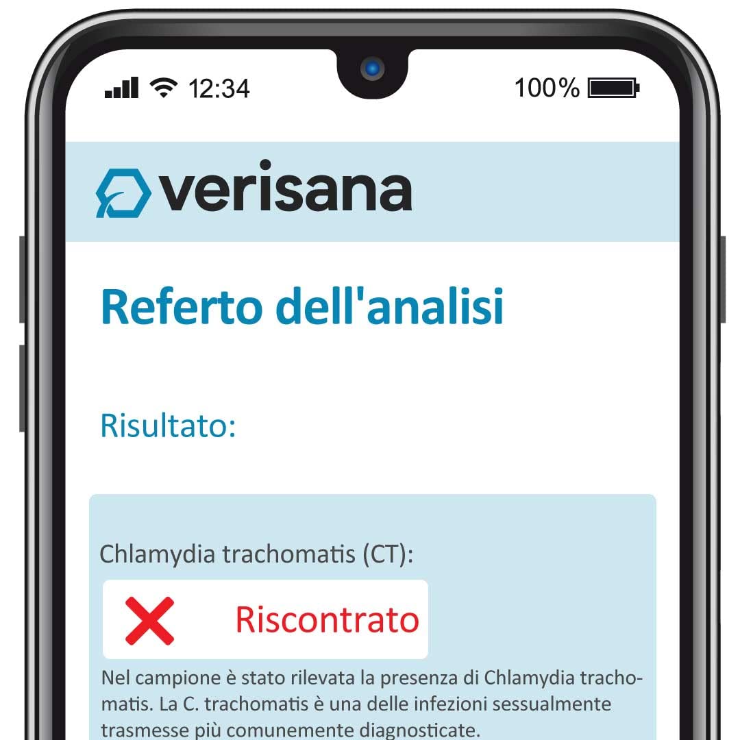 Test Plus donna per Malattie Sessualmente Trasmissibili (MST) - Test completo per la diagnosi di 9 tra le più comuni infezioni sessualmente trasmesse - Rapido, facile e discreto a casa - Verisana