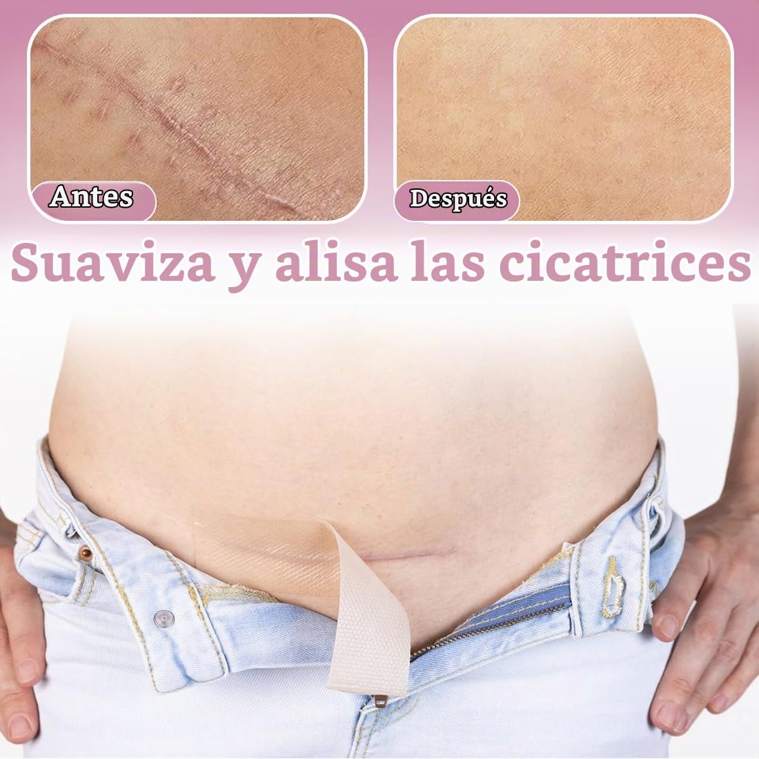 2 Piezas de láminas de Silicona para Cicatrices,Parches de gel para la Cara,Transparentes,Diseño Invisible, Cubren Eficazmente las Cicatrices, 4 cm x 150 cm