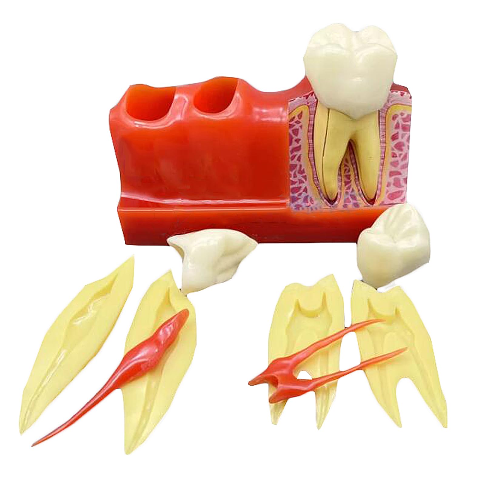 4-Faches Zahnimplantat-Modell – Zahnarztpraxis Implantat-Modell – Für Labor-Dental, Pädagogische Analyse