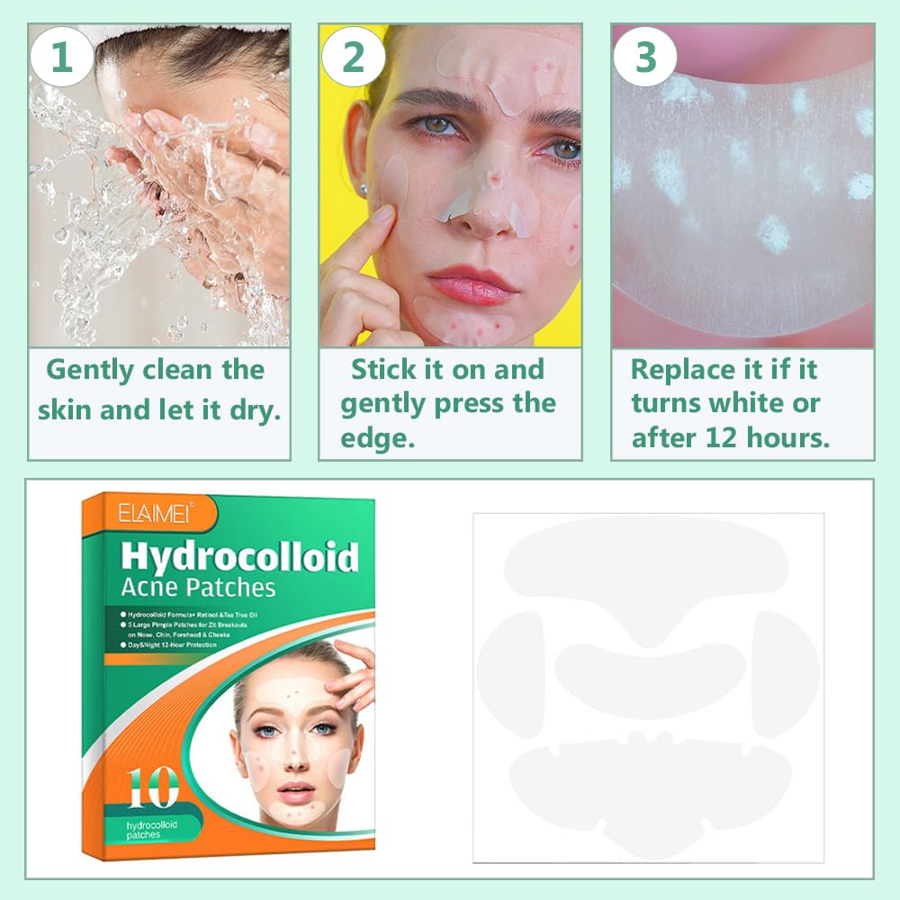 1 Box Acne Patch,Large Pimple Patch Spot Control Cover, Acne Patch for Covering Large Breakouts, Spot Patch, Pimple Stickers for Body, Cheek, Forehead, Chin Effectively Calms & Relieves Acne - Image 3