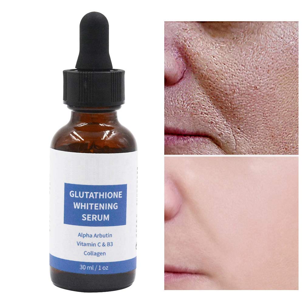 alpha arbutin and glutathione together Say hello to radiant, even-toned skin with our Glutathione Serum + 2% Alpha  Arbutin! Formulated to fight dullness, reduce dark spots, and reveal your  inner glow. Gentle. Powerful. Glow-enhancing. 🌟 Your skincare main image 1