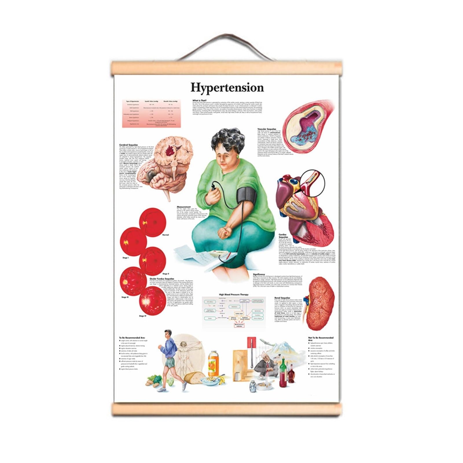 1 Szt. Nadciśnienie Plakaty Drukuje Tablica Ścienna Anatomia Człowieka Obraz Płótno Artystyczne Przewiń Malowanie Szpitale Kliniki Ozdobne Malowidło Ścienne(Scroll Painting,30X40 CM)