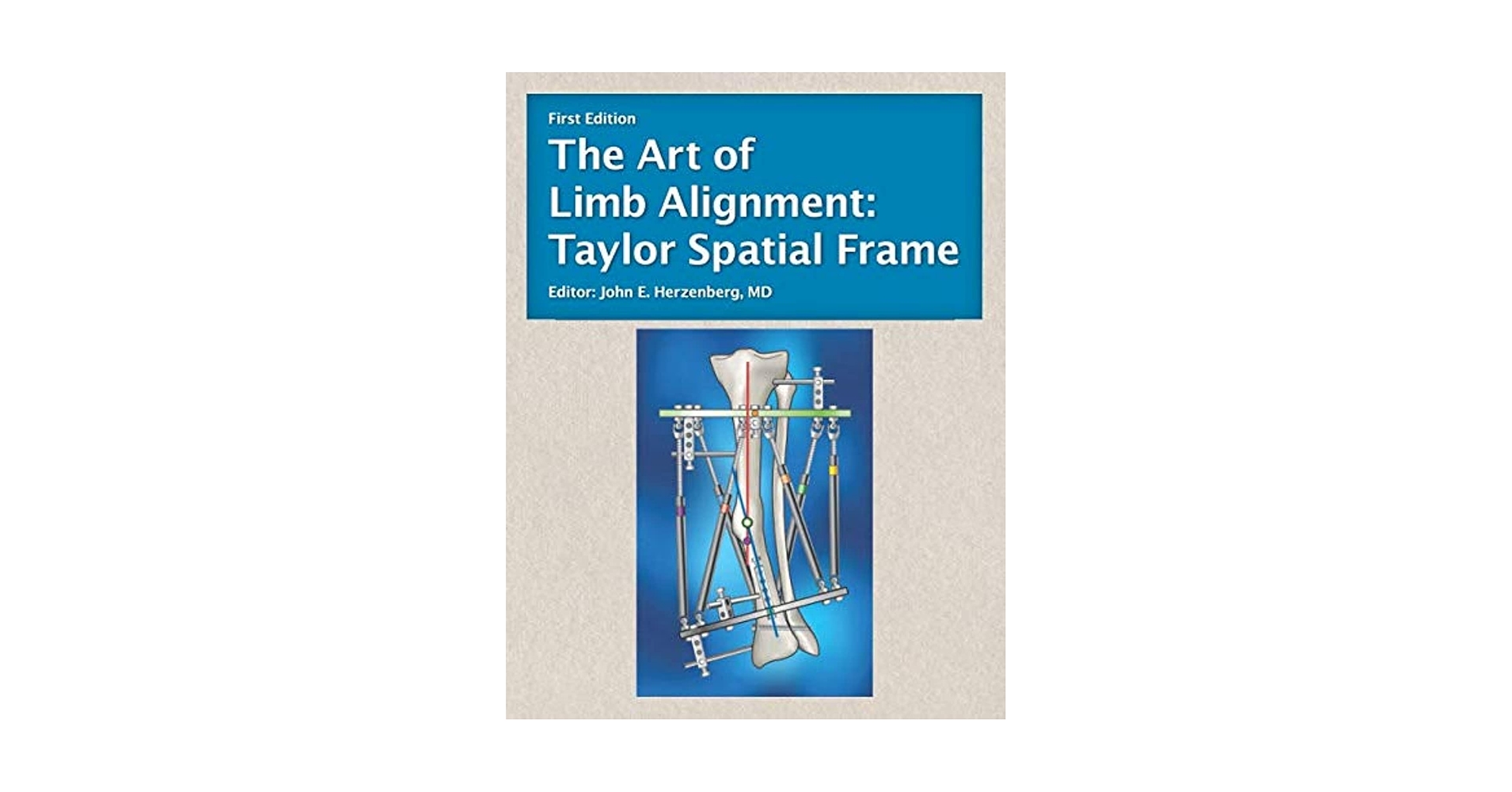健康・医学 The Art of Limb Alignment, 12th Edition Amazon.com: The Art of Limb Alignment: Taylor Spatial Frame