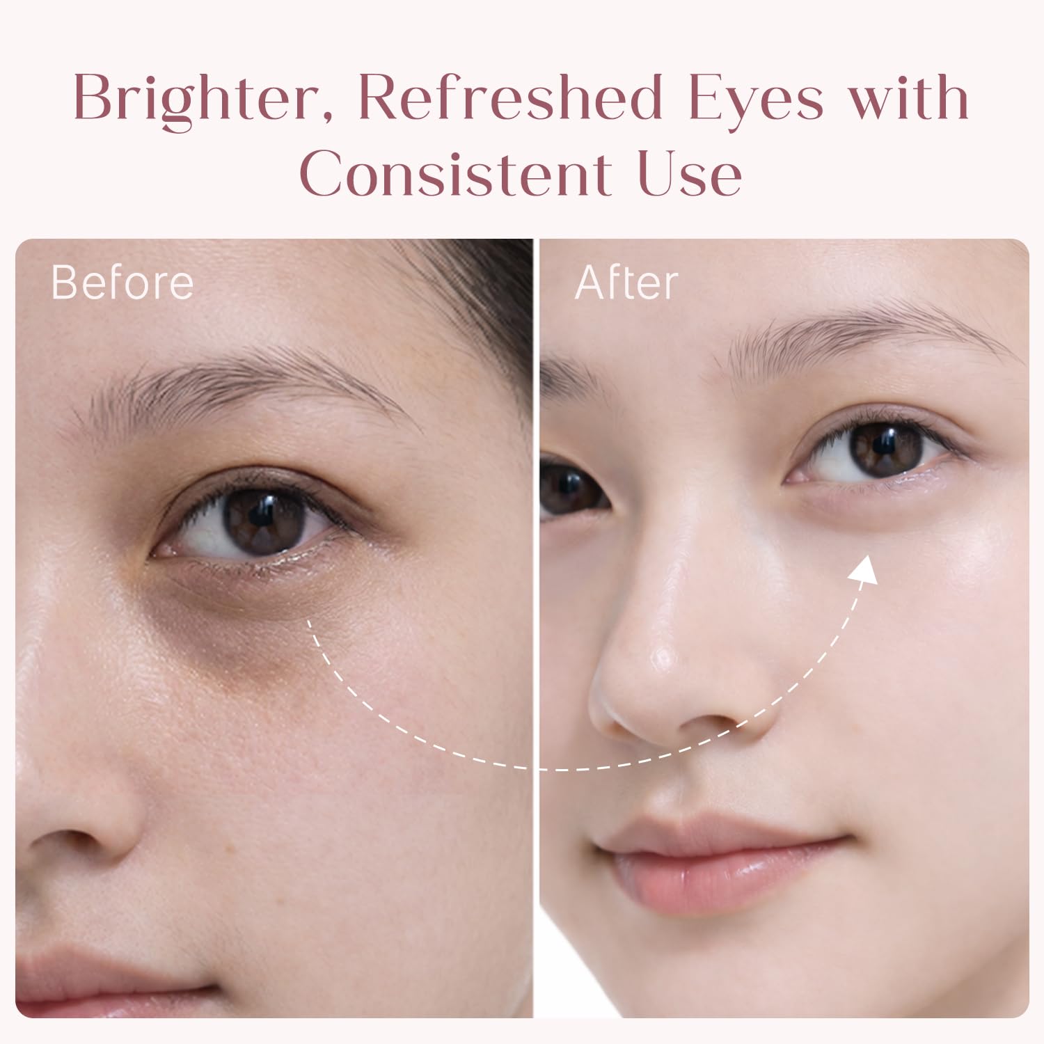 Seoulskin under eye cream | dark circles removal for women and men | Under Eye Gel to Reduce Dark Circles, Puffiness & Wrinkles With Built-in Cooling Massage Roll-On Applicator | 5% Niacinamide, 2% Alpha Arbutin | 15 ml — Amazon image 4