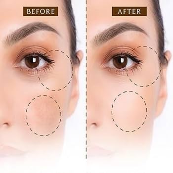 67 Stores Dark Circle Eye Serum for Eye Bags, Smoothing Wrinkles,  Anti-Aging Skincare 30ml : Amazon.in: Beauty