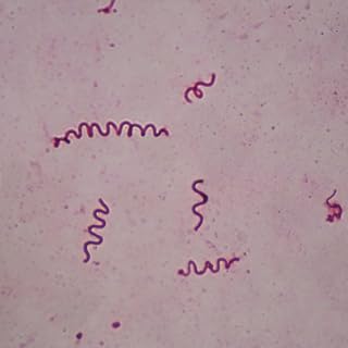 Spirillum volutans, w.m. Microscope Slide