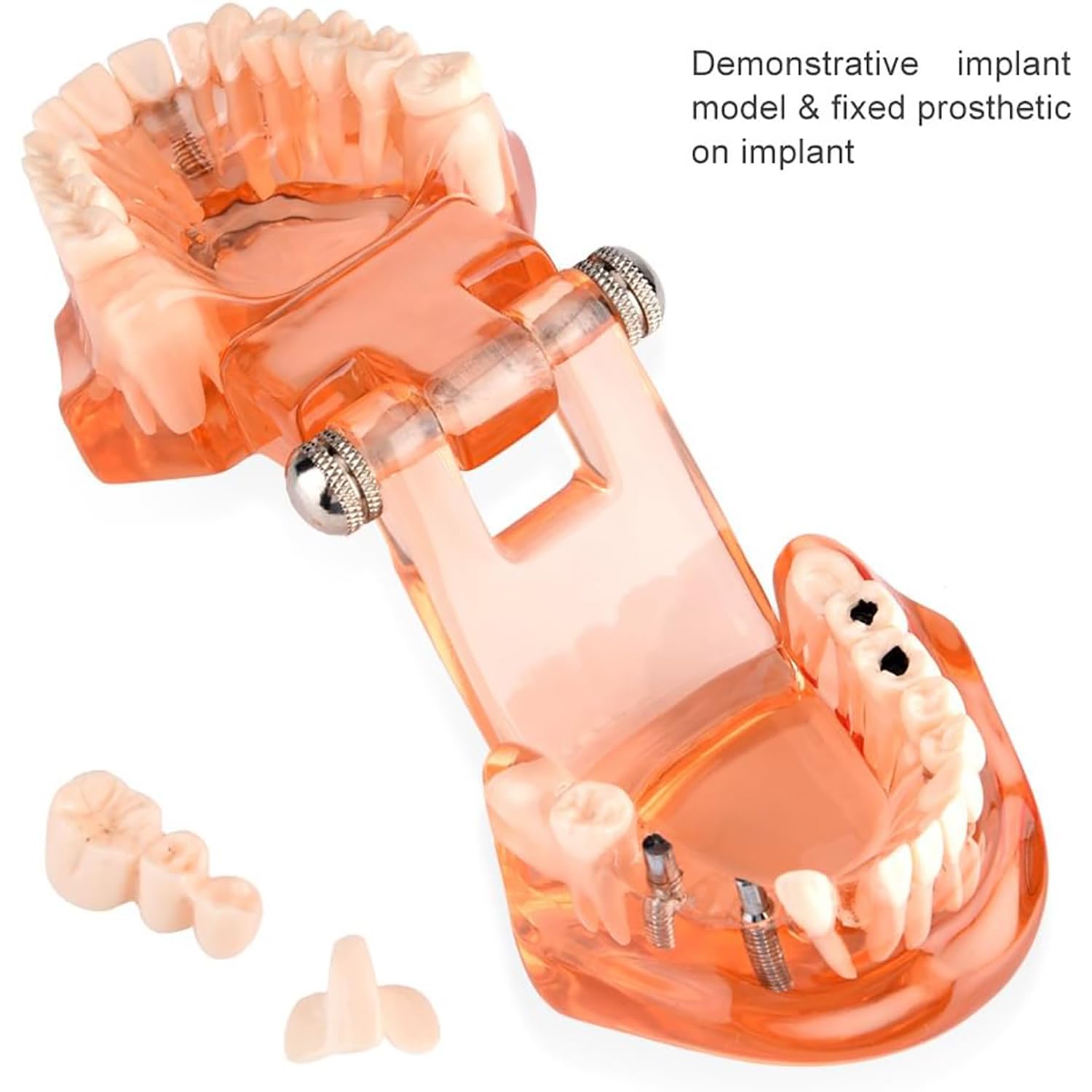 Pomarańczowy zdejmowany model zębów dentystycznych, model dentystyczny, nauczanie chorób zębów, model zębów implantologicznych, do komunikacji lekarz-pacjent