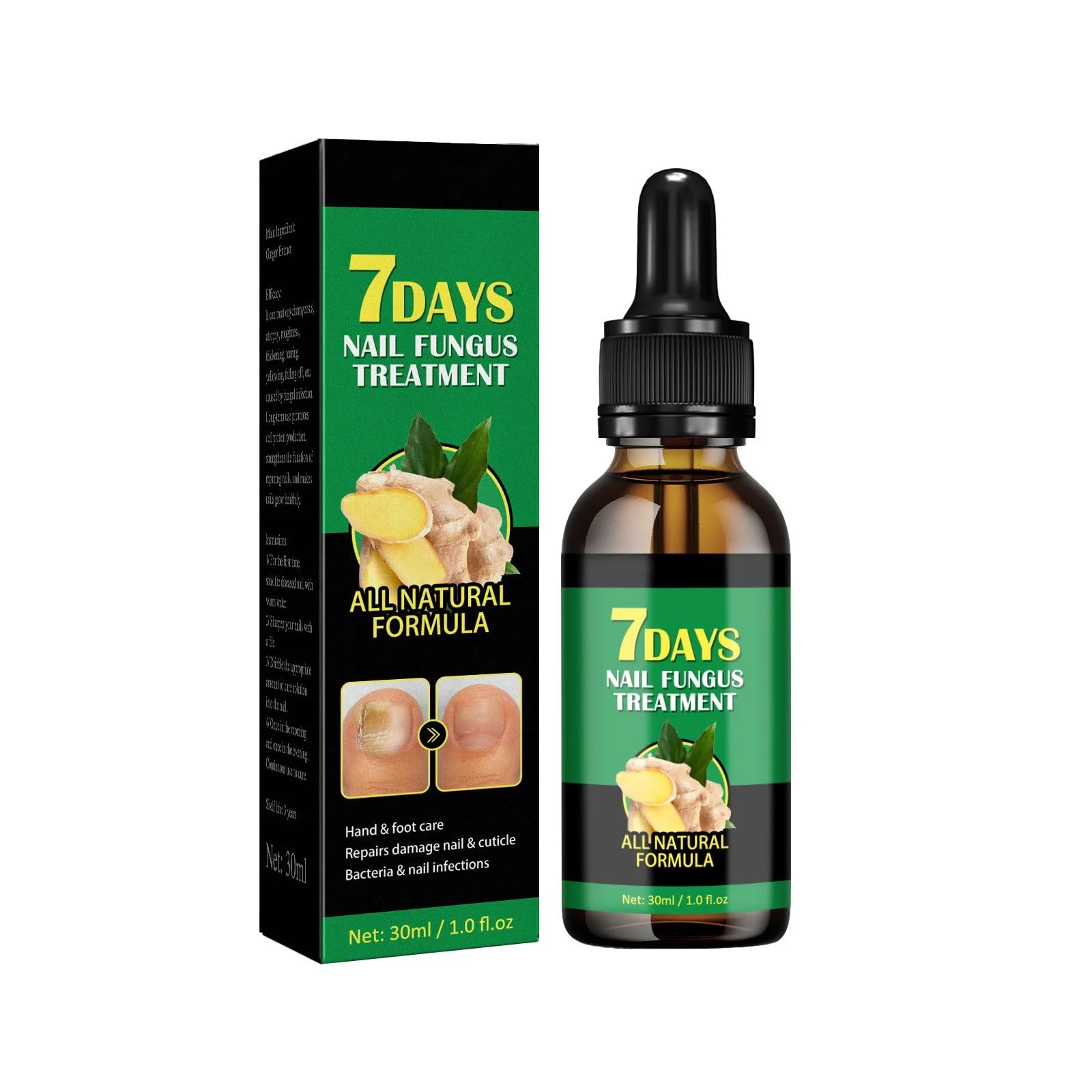 Ginger Nail Treatment – Nail Growth Serum & Cuticle Care Oil, 7 days Damaged & Brittle Nails – Strengthens, Restores & Promotes Growth – Cuticle & Nail Treatment, Natural Hydrating Nail Strengthener