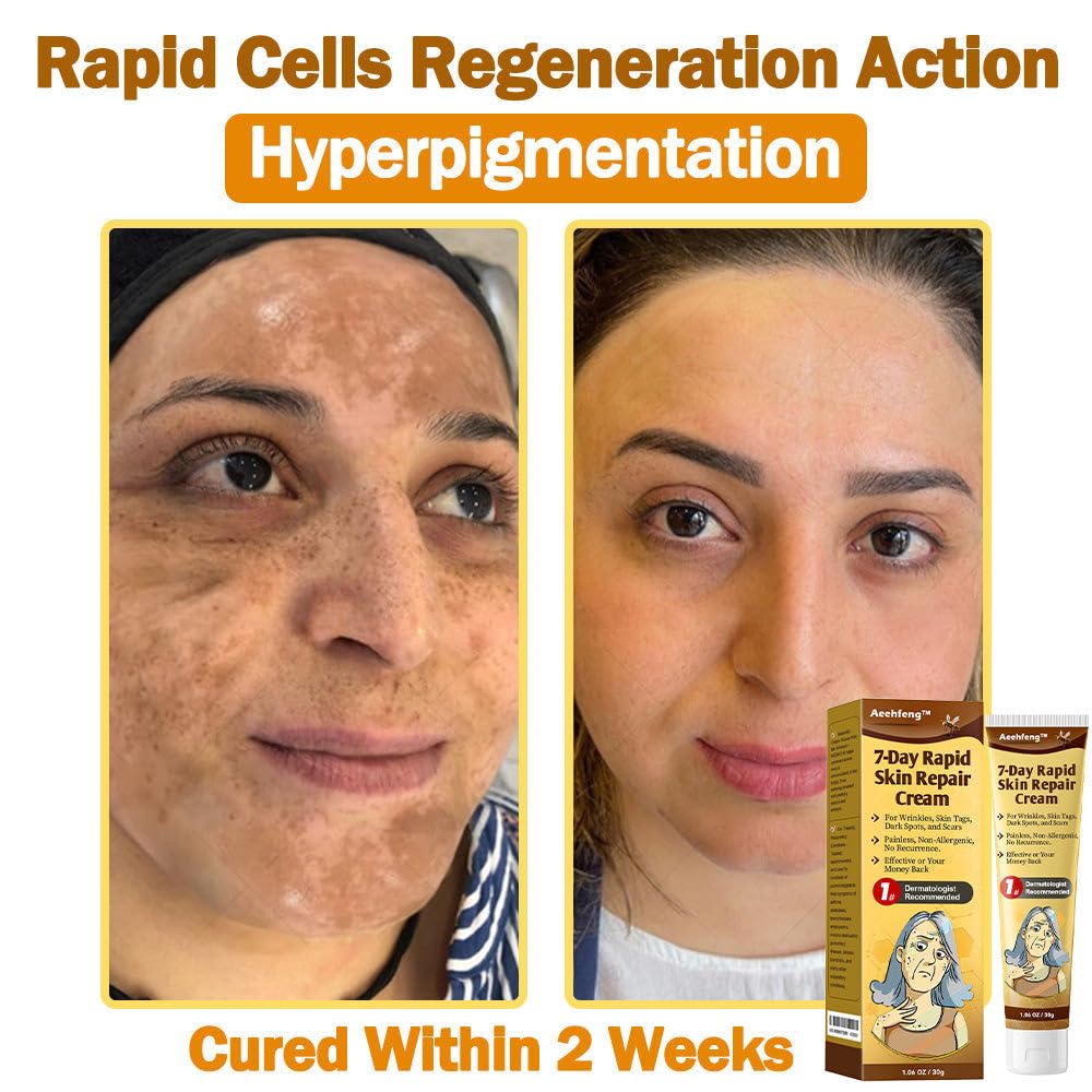 7-Day Rapid Skin Repair Cream,Intense Skin Cream,All-in-one skin