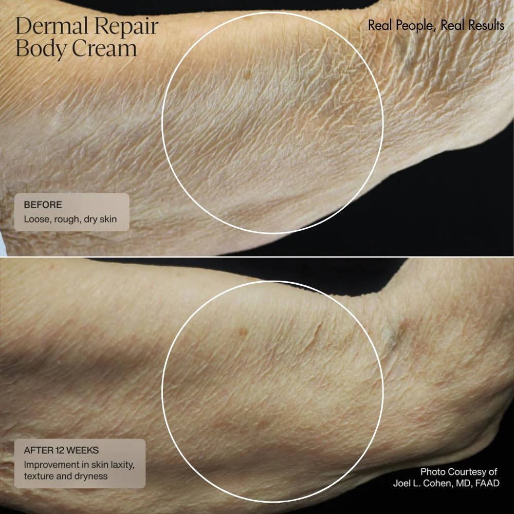 Senté Dermal Repair Body Cream | Restore Skin's Barrier | Soothes Sensitive Skin | Promotes New Collagen Production for Firmer Skin | 6 Fl Oz