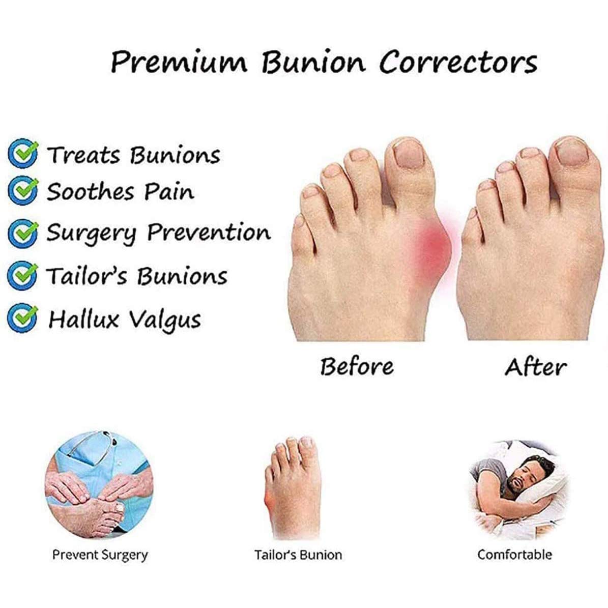 Sandalias de corrección ósea del Dedo Gordo del pie para Mujer Zapatos ortopédicos de Piel de Vaca con Punta Abierta Zapatillas correctoras de juanetes Hallux Valgus con Soporte de Arco para