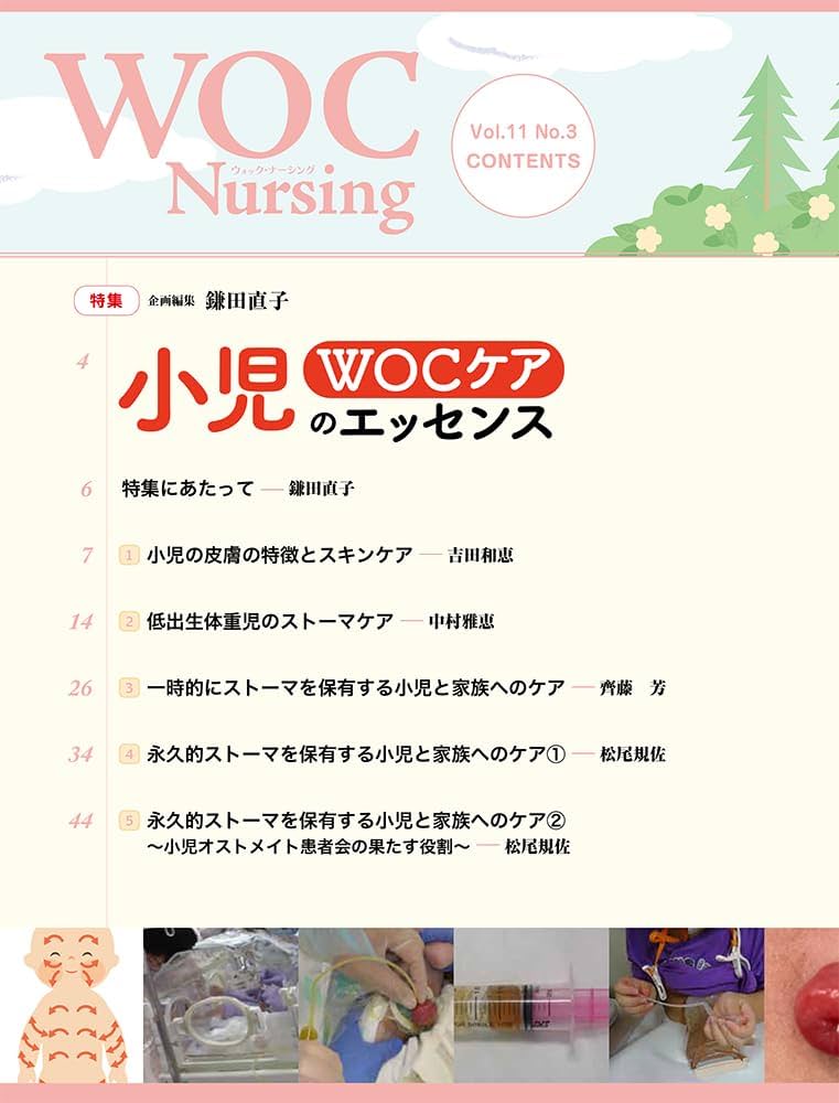 ＷＯＣ　Ｎｕｒｓｉｎｇ ＷＯＣ（創傷・オストミー・失禁）予防・治療・ケア Ｖｏｌ．７Ｎｏ．９（２０１９/医学出版（単行本） Amazon.co.jp: WOC Nursing: WOC(創傷・オストミ-・失禁)予防