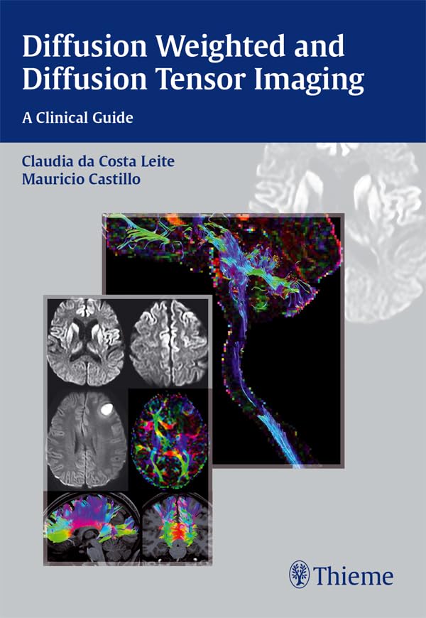 Diffusion Weighted and Diffusion Tensor Imaging: A Clinical Guide