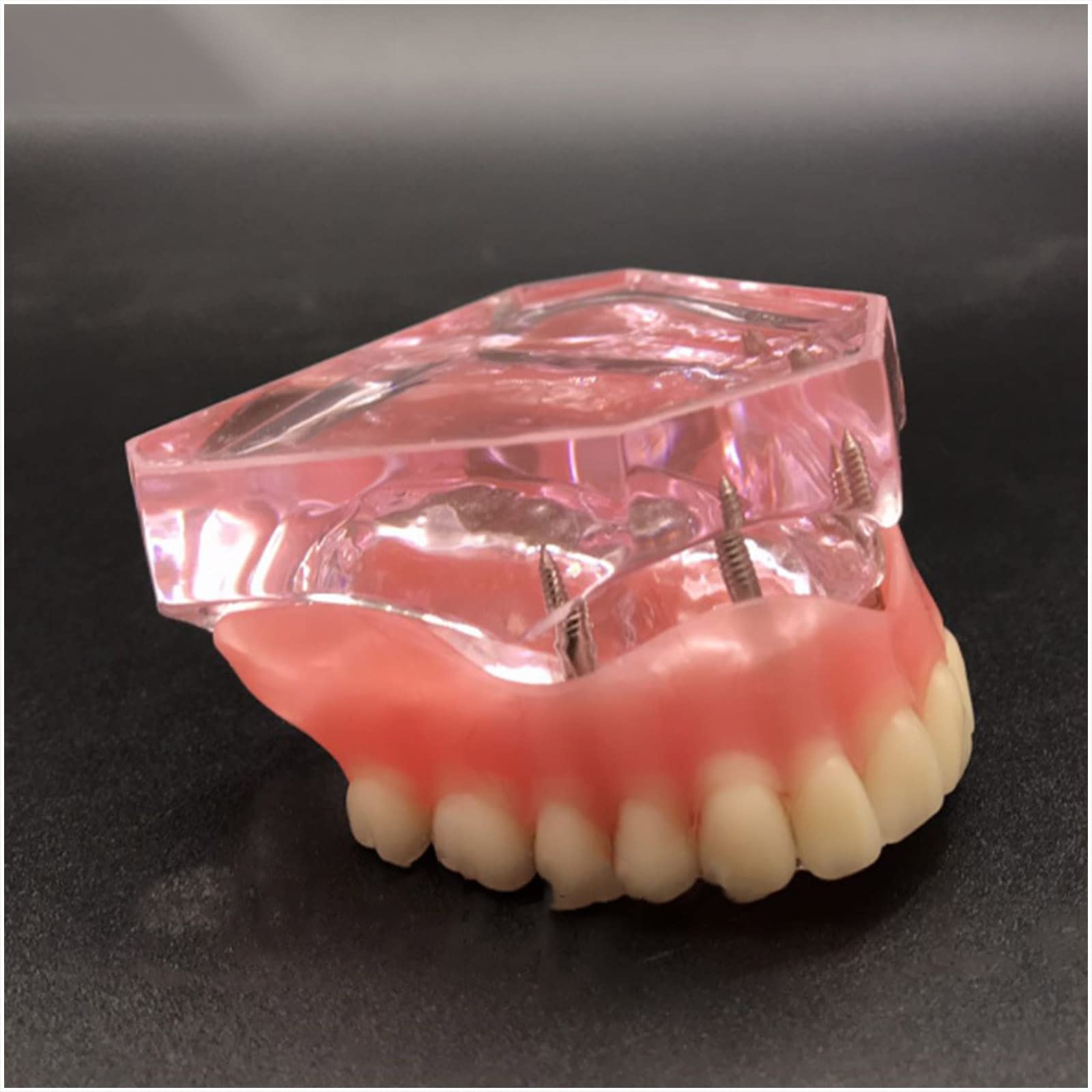 Modello di impianto Dentale - Modello di Protesi dentaria overdenture a 4 impianti - Modello di Denti dentali dimostrativo Trasparente per Studio Modello didatt，Upper Teeth