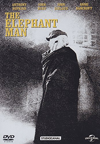 The Elephant Man
